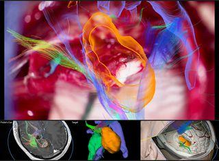 Image Guided Surgery